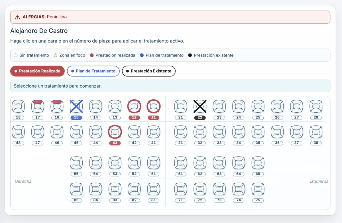 Odontograma FDI digital interactivo con registro de tratamientos por cara dental